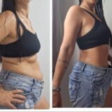 PROJETO SECA BARRIGA